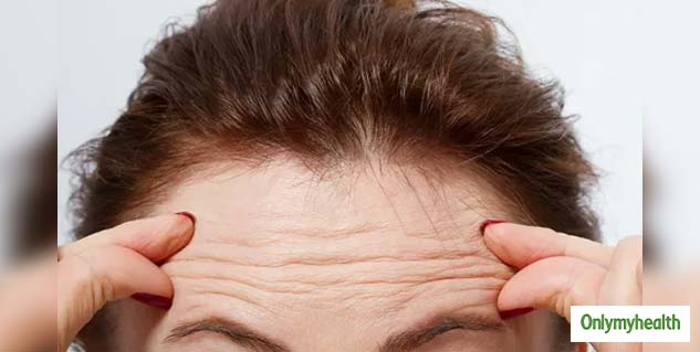 Treatment Of Forehead Wrinkles
