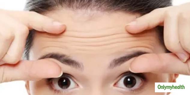 Wrinkle 