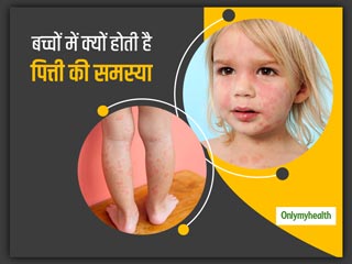 बच्चों में क्यों होती है पित्ती की ज्यादा शिकायत, जानें क्या है इससे बचाव और घरेलू इलाज