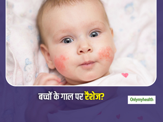 बच्चों के गाल पर रैशेज, बुखार, थकान हो सकते हैं 'फिफ्थ डिजीज' के संकेत, एक्सपर्ट से जानें क्या है ये बीमारी