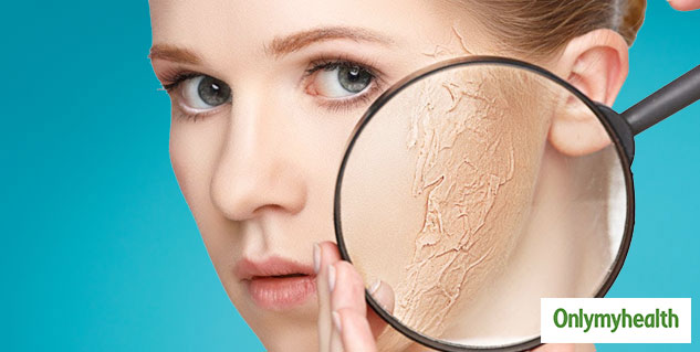 dead skin cells 