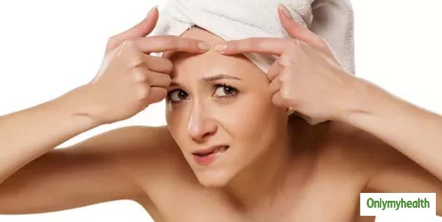 How to Deal With Hairline Acne