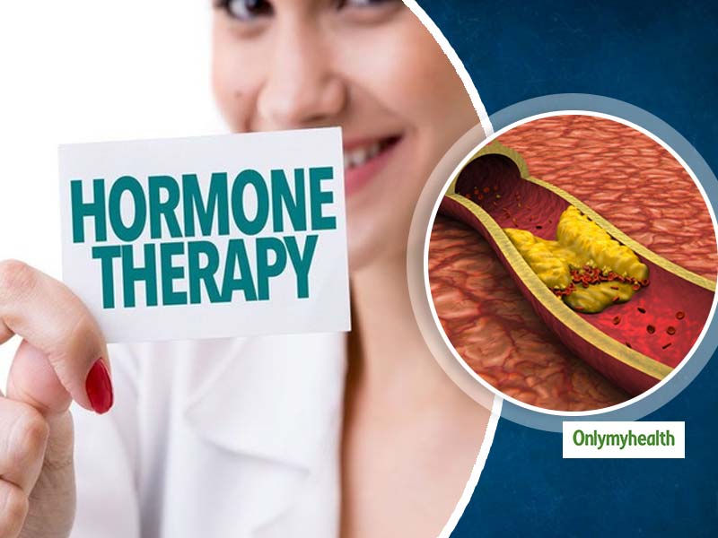 मेनोपॉज के बाद महिलाओं में धमनियों में रुकावट (एथेरोस्क्लेरोसिस) की प्रगति को धीमा करती है हार्मोन थेरेपी