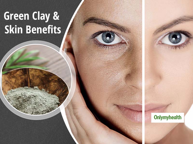 Green Clay Is A Boon For Beauty, Make DIY Green Clay Masks To Treat You Skin