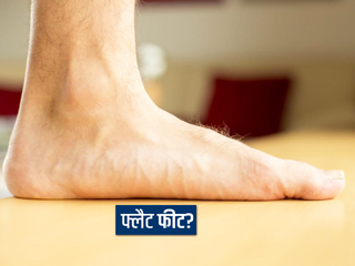 Flat Foot: फ्लैट फुट (सपाट तलवे) को न करें नजरअंदाज, कुछ बीमारियों का भी हो सकता है संकेत