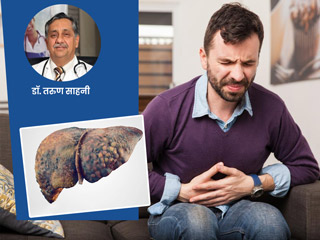फैटी लिवर के होते हैं ये 4 मुख्य स्टेज, डॉक्टर से जानें इन स्टेज के खतरे और बचाव के लिए उपाय