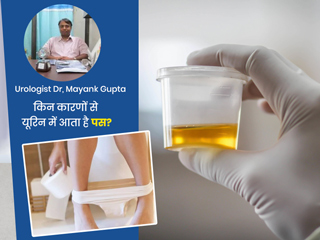 पेशाब के साथ पस आने के क्या हो सकते हैं कारण? यूरोलॉजिस्ट से जानें इसके लक्षण, खतरे और इलाज