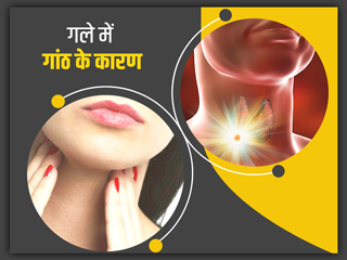 निगलने में परेशानी और खराश जैसे लक्षण हो सकते हैं गले में गांठ का संकेत, जानें इसके कारण, लक्षण और इलाज