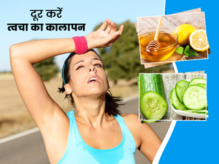 धूप के कारण झुलसी त्वचा का कालापन दूर करेंगे ये आसान घरेलू नुस्खे, त्वचा पर आएगा नैचुरल ग्लो