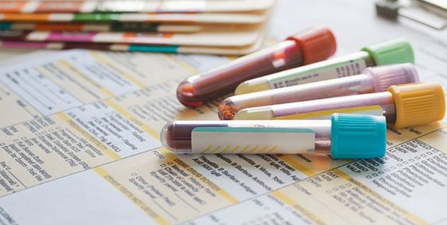 blood test