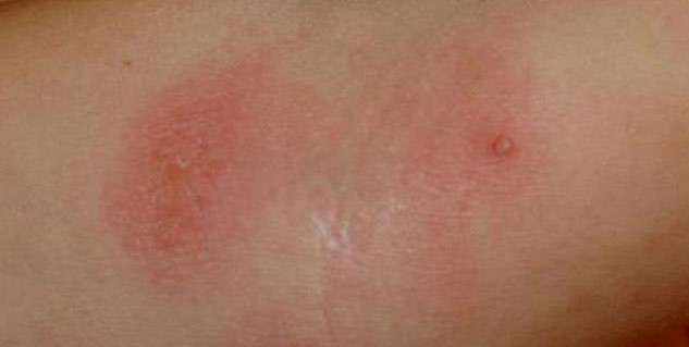 Inside2_gulabbasbenefits