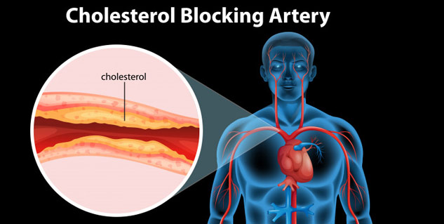 cholestrol level