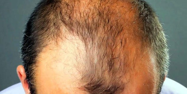 Inside4_Karanjabenefits