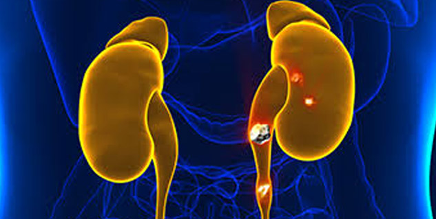 Can your Bladder Burst when you Hold your Pee?! A Urologist