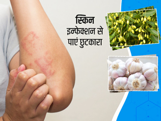स्किन इन्फेक्शन से छुटकारा पाने के लिए करें इन 5 घरेलू नुस्खों का सेवन