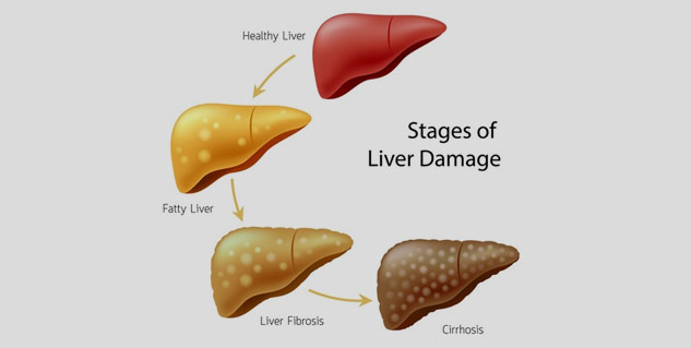 Inside4liverdamage
