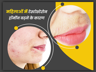 महिलाओं में टेस्टोस्टेरोन हार्मोन बढ़ने से हाने वाली समस्याएं, डॉक्टर से जानें इसके कारण और बचाव