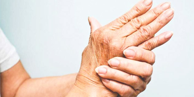 arthritis