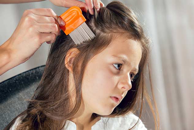 head lice home remedies