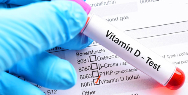 vitamin D test