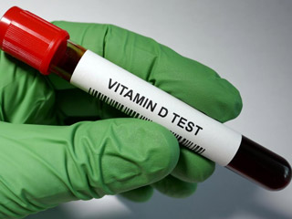Vitamin D Test: शरीर के लिए क्यों जरूरी है विटामिन डी और कैसे किया जाता है विटामिन डी टेस्ट? जानें जरूरी बातें