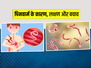 किन कारणों से बच्चों को होता है पिनवार्म? जानिए इसके लक्षण, कारण और बचाव के तरीके