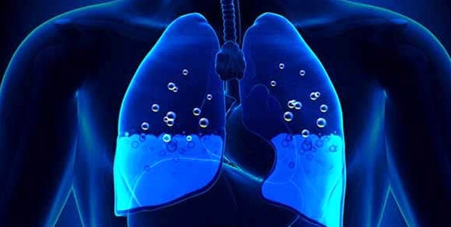 what-causes-fluid-buildup-in-the-lungs-here-s-everything-you-need-to