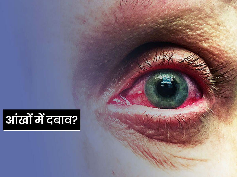 आंखों में महसूस हो रहे दबाव का कारण हो सकता है ग्लूकोमा (मोतियाबिंद), जानें कैसे करता है ये आंखों को प्रभावित
