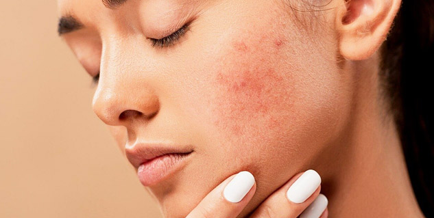 skinproblem