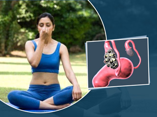 PCOD की समस्या से हैं परेशान? इन 3 योगासन अपनी समस्याओं को करें कंट्रोल