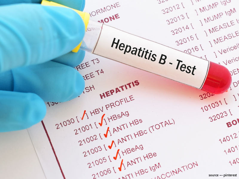 Hepatitis B: Types, Symptoms, Diagnosis And Treatment 