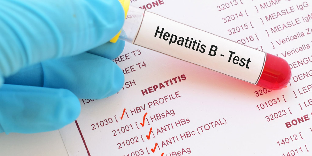 Hepatitis B: Types, Symptoms, Diagnosis And Treatment | Onlymyhealth