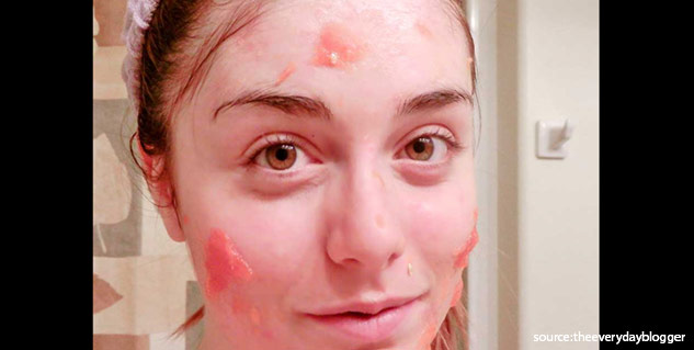 facepack for oily skin