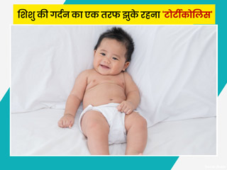शिशु की गर्दन का एक तरफ झुके रहना हो सकता है 'टोर्टीकोलिस' का संकेत, जानें इसके कारण और इलाज