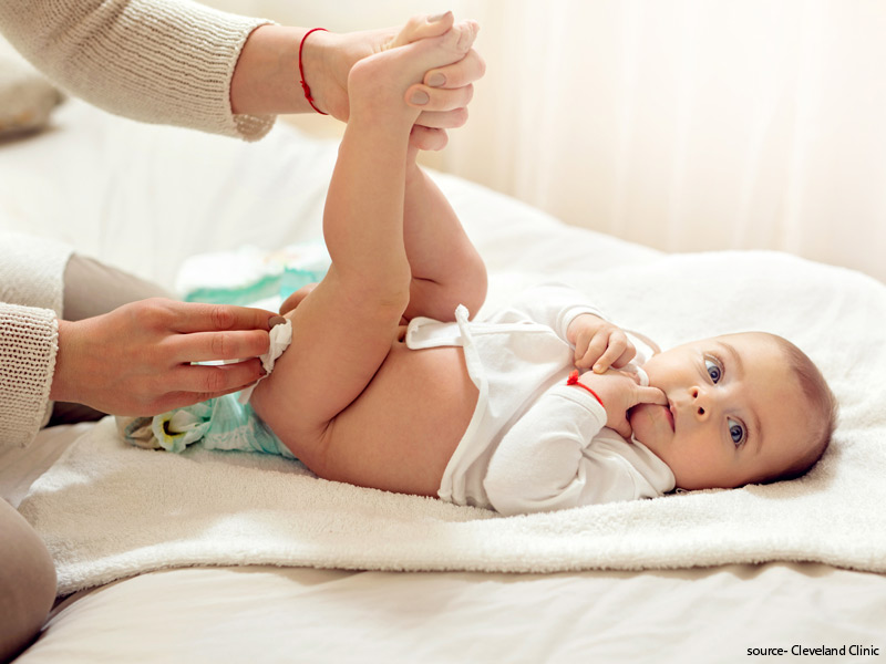 Diaper Rash Is Common In Babies During Monsoon, Here’s How You Can Prevent & Treat It