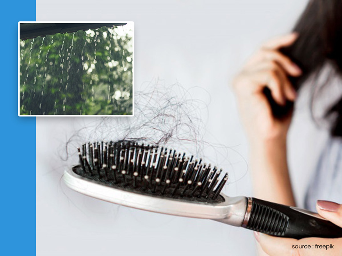 Struggling With Hair Loss This Monsoon? Try These Home Remedies For Healthy  Locks