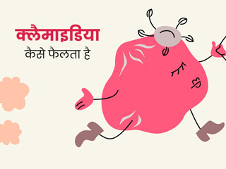 यौन संचारित बीमारी क्लैमाइडिया कैसे फैलती है? जानें इसके लक्षण, कारण, इलाज और बचाव के बारे में