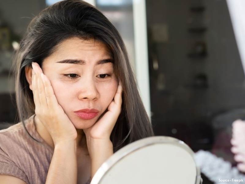 Trying To Get Rid Of Stubborn Dark Circles? Try These Home Remedies