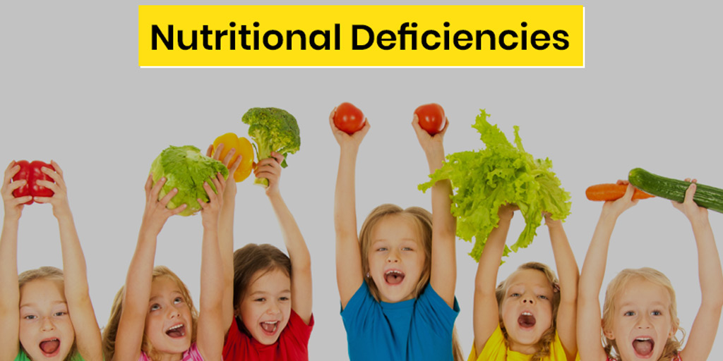 nutritional-deficiencies-in-children-early-signs-causes-and-diseases