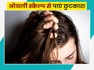 ऑयली स्कैल्प और ग्रीसी बालों से छुटकारा पाने के लिए अपनाएं ये 5 घरेलू उपाय