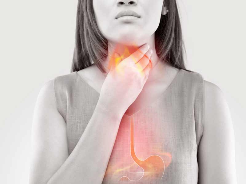 Acid Reflux: Causes, Symptoms & Food Items To Avoid In This Condition 