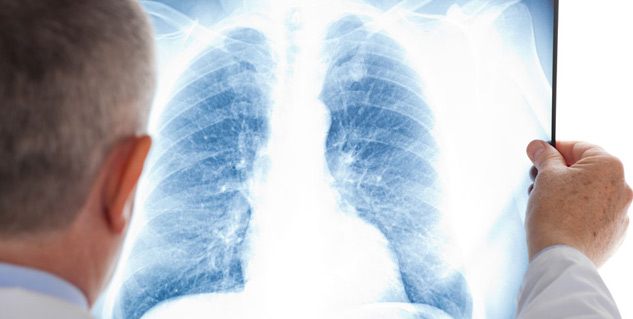 Inside1_chestinfection