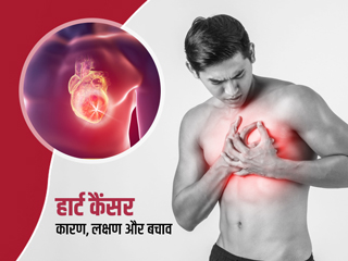 हार्ट में कैंसर होने किन कारणों से होता है? डॉक्टर से जानें इसके शुरुआती लक्षण और इलाज के तरीके