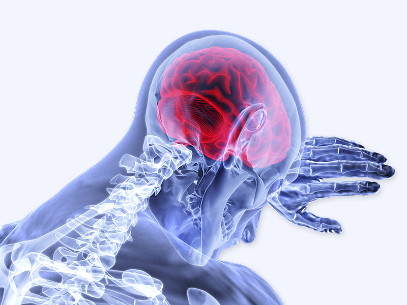मस्तिष्क (ब्रेन) में सूजन के लक्षण, कारण और इलाज