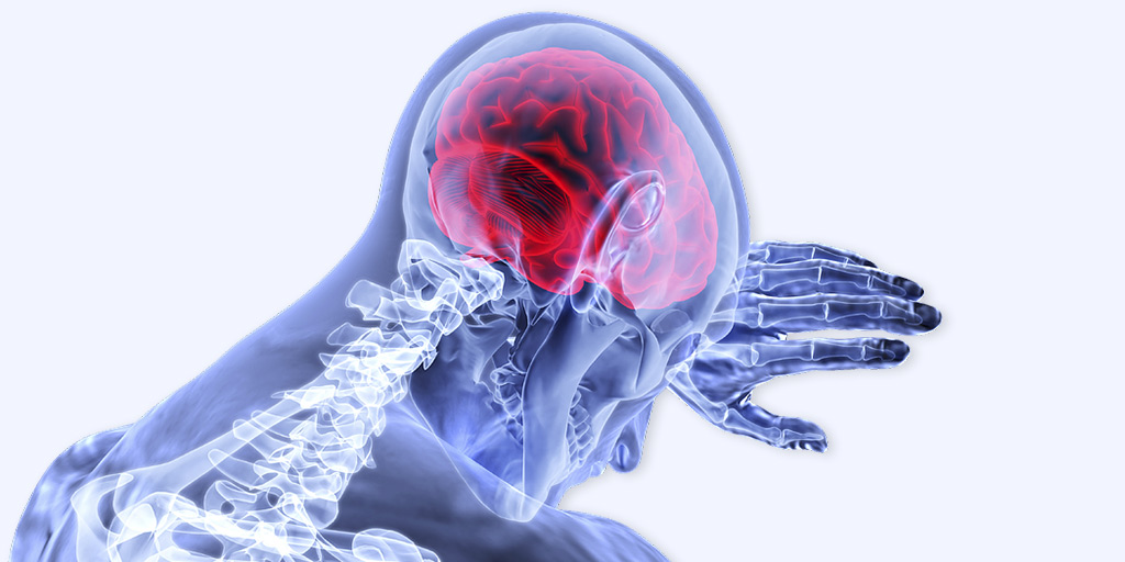 Cerebral Edema Causes, Symptoms and Treatment in Hindi | मस्तिष्क (ब्रेन) में सूजन के लक्षण, कारण और इलाज