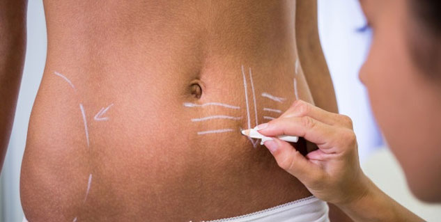 Is Body Contouring Treatment Safe? Know Other Treatment Options for  Cellulite Removal
