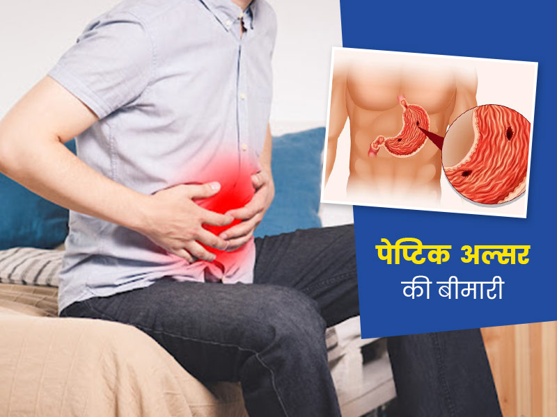 Peptic Ulcer Disease: बार बार एसिडिटी होने का कारण हो सकती है ये बीमारी, डॉक्टर से जानें कारण और लक्षण