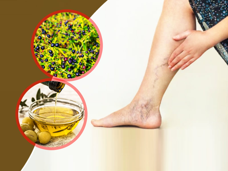 5 Ayurvedic Herbs To Treat Condition Of Varicose Veins