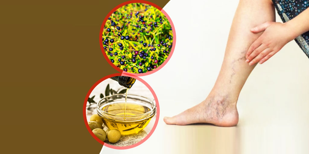 5 Ayurvedic Herbs To Treat Condition Of Varicose Veins | Onlymyhealth