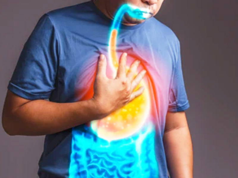 Gastroesophageal Reflux Disease: Diagnosis And Treatment